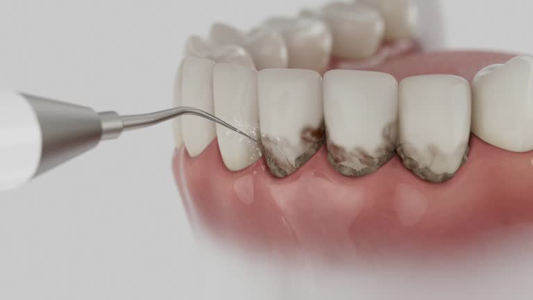 Reliable Dental contractor in Ward, AR by Smile Center Dentistry
